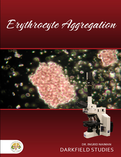 Erythrocyte Aggregation